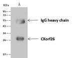 PBDC1 Antibody in Immunoprecipitation (IP)