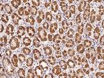 PBXIP1 Antibody in Immunohistochemistry (Paraffin) (IHC (P))