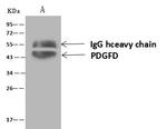 PDGF-D Antibody in Immunoprecipitation (IP)