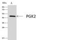 PGK2 Antibody in Immunoprecipitation (IP)