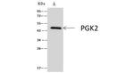 PGK2 Antibody in Immunoprecipitation (IP)