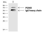 PGM2 Antibody in Immunoprecipitation (IP)