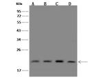 PIGP Antibody in Western Blot (WB)