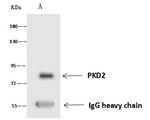 PKD2 Antibody in Immunoprecipitation (IP)