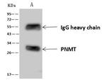 PNMT Antibody in Immunoprecipitation (IP)