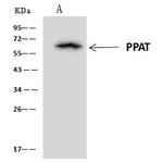 PPAT Antibody in Immunoprecipitation (IP)