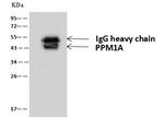 PPM1A Antibody in Immunoprecipitation (IP)