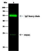 PRDX1 Antibody in Immunoprecipitation (IP)