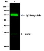 PRDX1 Antibody in Immunoprecipitation (IP)