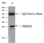 PRDX4 Antibody in Immunoprecipitation (IP)