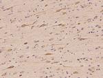 PRKAR1A Antibody in Immunohistochemistry (Paraffin) (IHC (P))