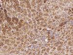 PRKAR2B Antibody in Immunohistochemistry (Paraffin) (IHC (P))