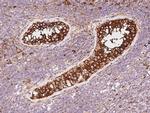 PRKAR2B Antibody in Immunohistochemistry (Paraffin) (IHC (P))