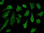 PRKD2 Antibody in Immunocytochemistry (ICC/IF)