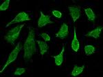 PRKD2 Antibody in Immunocytochemistry (ICC/IF)