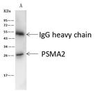 PSMA2 Antibody in Immunoprecipitation (IP)