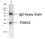 PSMA2 Antibody in Immunoprecipitation (IP)