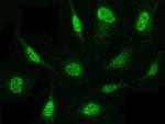 PSMB8 Antibody in Immunocytochemistry (ICC/IF)