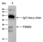 PSMB8 Antibody in Immunoprecipitation (IP)