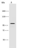 PSMD2 Antibody in Western Blot (WB)