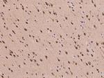 PSMD7 Antibody in Immunohistochemistry (Paraffin) (IHC (P))