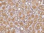 PSMD9 Antibody in Immunohistochemistry (Paraffin) (IHC (P))