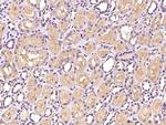 PTPN12 Antibody in Immunohistochemistry (Paraffin) (IHC (P))