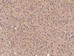 PTPN12 Antibody in Immunohistochemistry (Paraffin) (IHC (P))