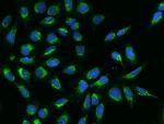 Bit1 Antibody in Immunocytochemistry (ICC/IF)