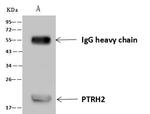 Bit1 Antibody in Immunoprecipitation (IP)