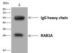 RAB1A Antibody in Immunoprecipitation (IP)