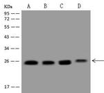 RAB1A Antibody in Western Blot (WB)