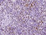 RAB27A Antibody in Immunohistochemistry (Paraffin) (IHC (P))