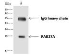 RAB27A Antibody in Immunoprecipitation (IP)