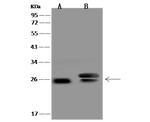 RAB27A Antibody in Western Blot (WB)