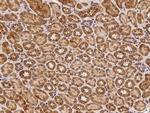 RAB7A Antibody in Immunohistochemistry (Paraffin) (IHC (P))