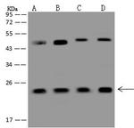 RAB7A Antibody in Western Blot (WB)