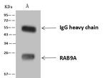 RAB9 Antibody in Immunoprecipitation (IP)