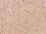 RBM17 Antibody in Immunohistochemistry (Paraffin) (IHC (P))