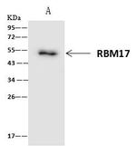 RBM17 Antibody in Immunoprecipitation (IP)