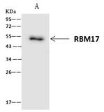 RBM17 Antibody in Immunoprecipitation (IP)