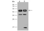 RBM17 Antibody in Western Blot (WB)