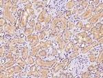 RDH14 Antibody in Immunohistochemistry (Paraffin) (IHC (P))