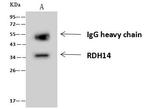 RDH14 Antibody in Immunoprecipitation (IP)