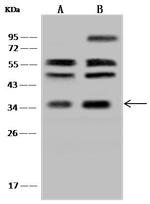 RDH14 Antibody in Western Blot (WB)