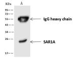 SAR1A Antibody in Immunoprecipitation (IP)