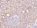 ACN9 Antibody in Immunohistochemistry (Paraffin) (IHC (P))