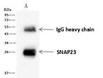 SNAP23 Antibody in Immunoprecipitation (IP)