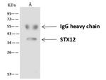 STX12 Antibody in Immunoprecipitation (IP)