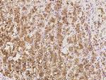 SULT2A1 Antibody in Immunohistochemistry (Paraffin) (IHC (P))